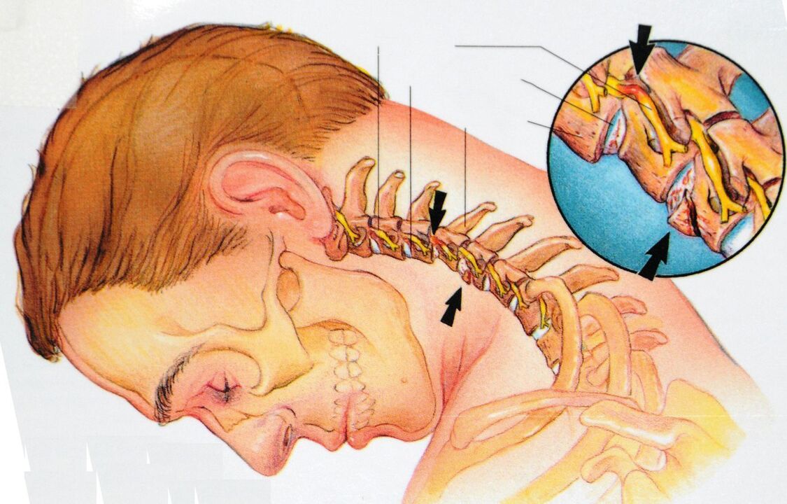 fájdalom a lapocka alatt háton fekve térdízületek orvosi kezelése